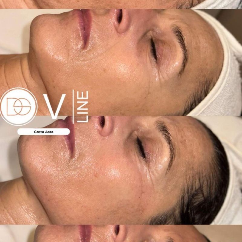 trattamenti estetica lady