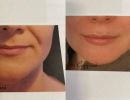 trattamenti estetica lady