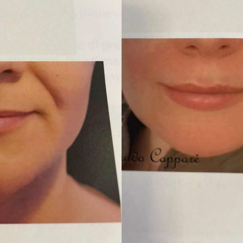 trattamenti estetica lady
